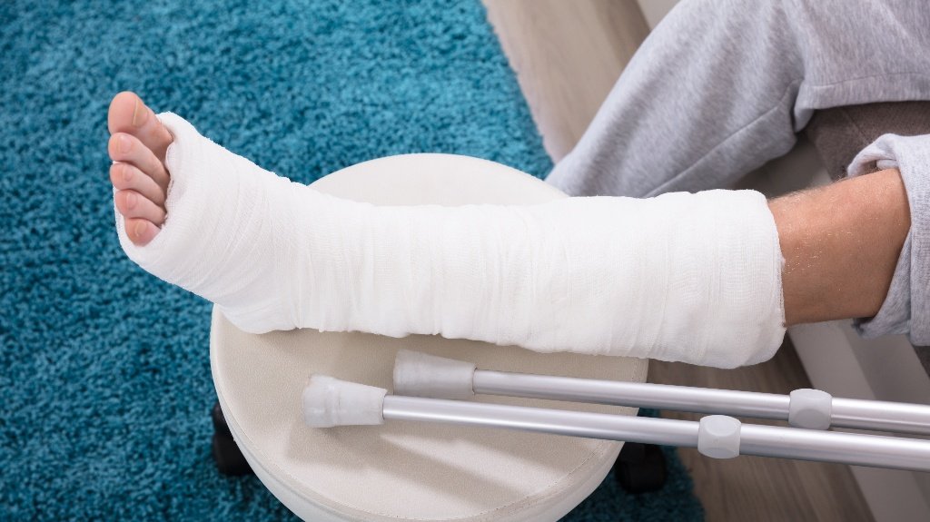 Poor lighting conditions contributing to slip and fall liability in Illinois lighting conditions slip and fall liability Illinois